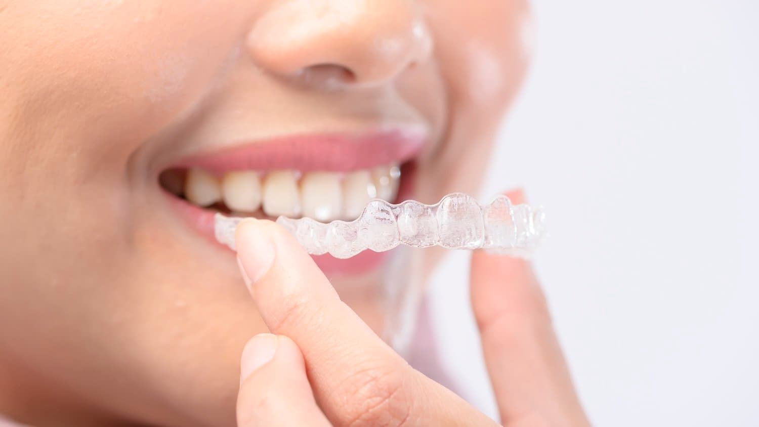 Dental-Vorsorge vom Experten – mit SIGNAL IDUNA in sicheren Händen