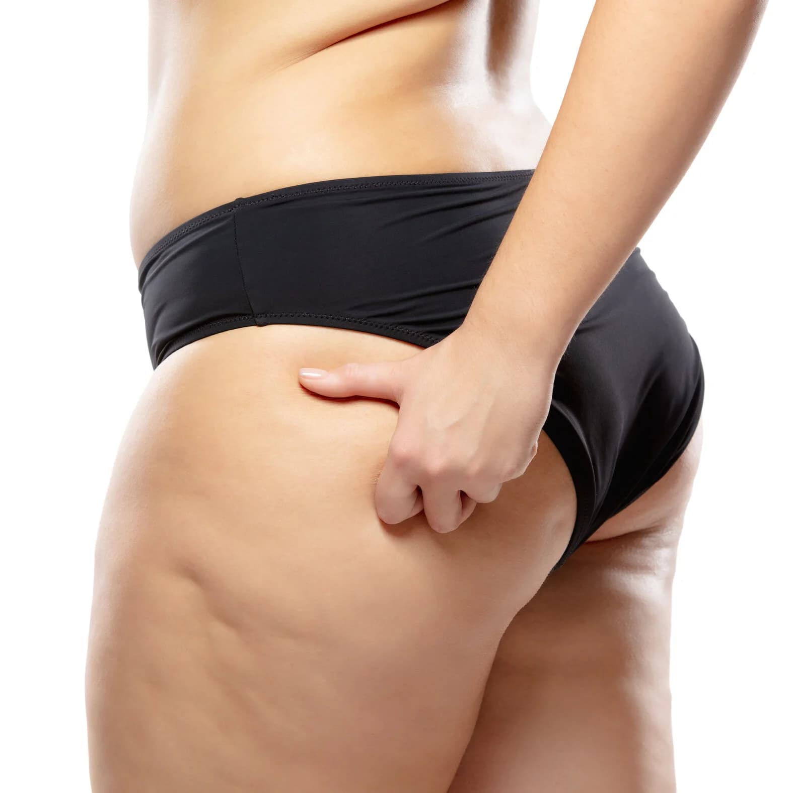 Behandlung bei Lipödem: Wann ist eine Liposuktion sinnvoll?