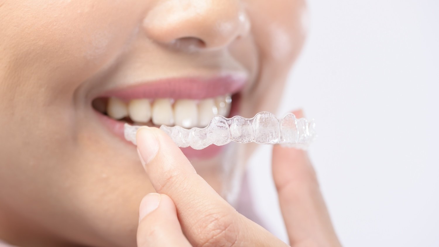 Dental-Vorsorge vom Experten – mit SIGNAL IDUNA in sicheren Händen